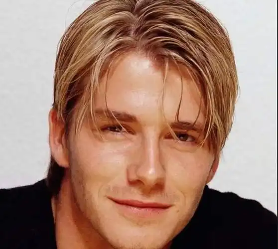 植发不靠谱?贝克汉姆1年前刚植发,如今又秃了