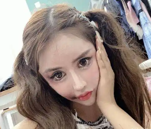 13岁开始整容的网红自曝整形失败!