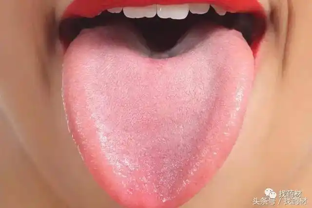 舌苔的颜色变化和五脏有什么关系(舌苔的11种不健康颜色)(1)
