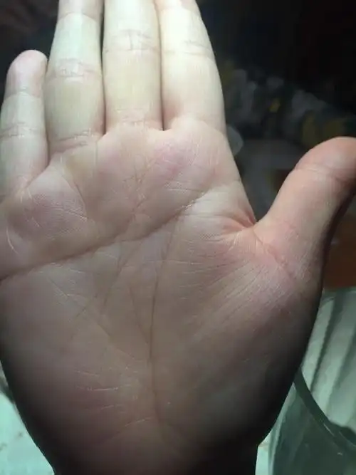 左右手掌纹差异很大,左手没智慧线?运势能说说吗?