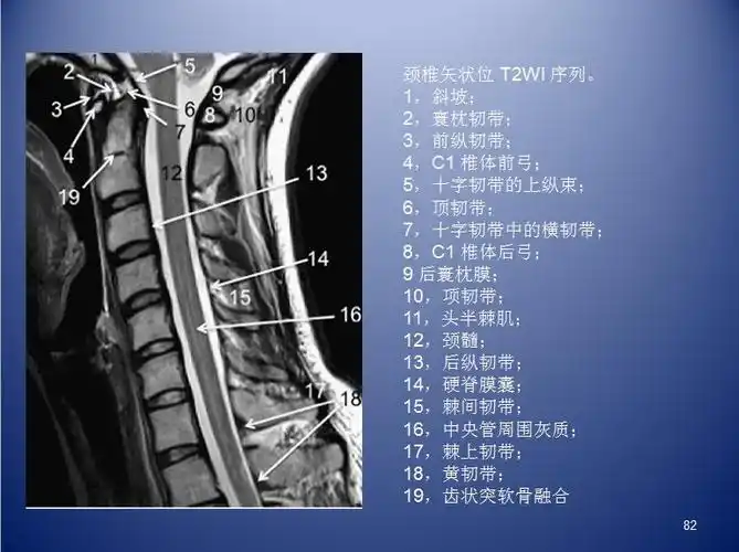 脊柱ct,mr断层解剖2