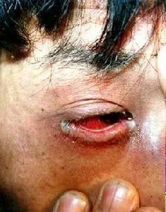 淋病患者需要进行检查