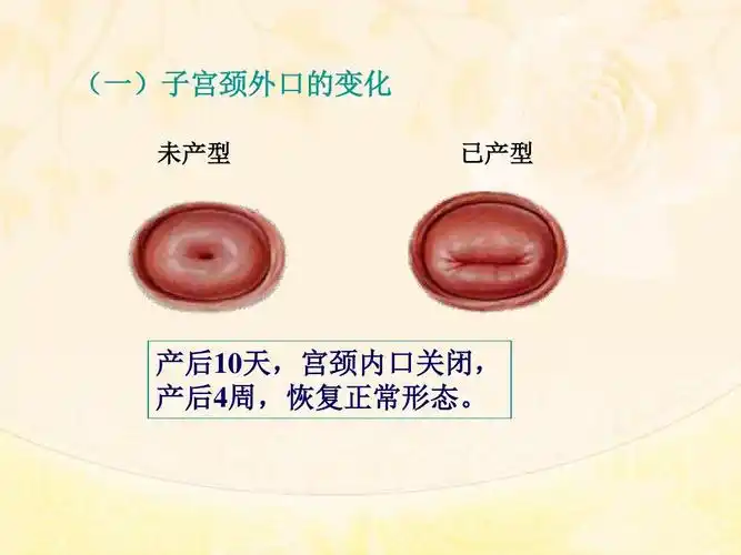 未产型 已产型 产后10天,宫颈内口关闭, 产后4周,恢复正常形态