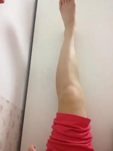 小腿特别弯怎么办阿 ? 今年17岁高二党 还有救么