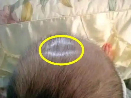 卤门是宝宝大脑发育的重要指标,过早过晚都不好,宝妈要引起重视