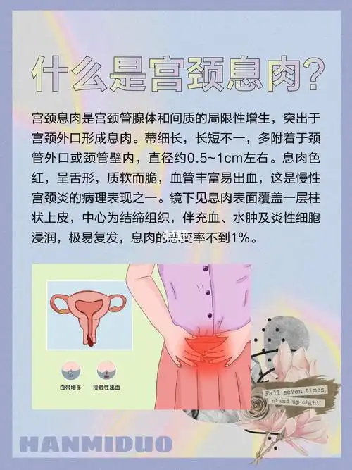 宫颈息肉恶变率低?可能导致你不孕!
