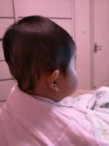 有同款宝宝吗?这头型还能长好吗?望各位留言.