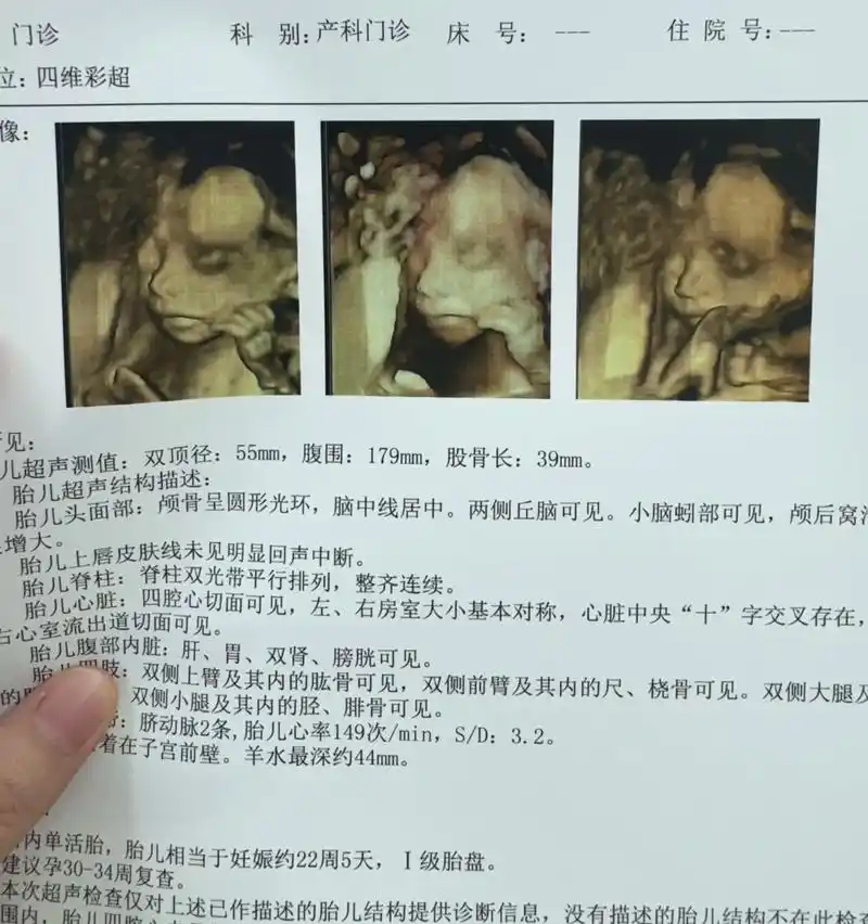 23周初次见面.神仙宝宝四维一次过,带的96都没用上,孕期没 - 抖音