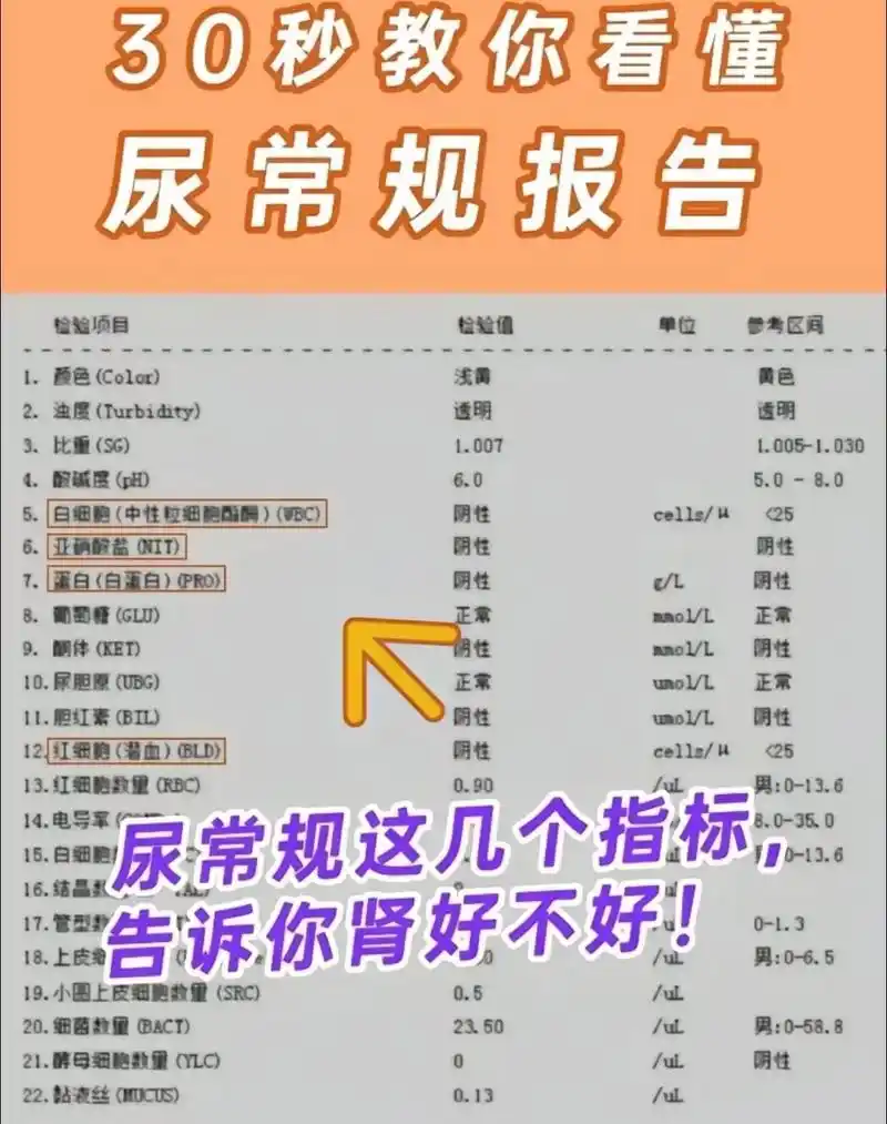 快速读懂尿常规报告 白色-尿路感染,前列腺炎,淋病等 见于溶 - 抖音